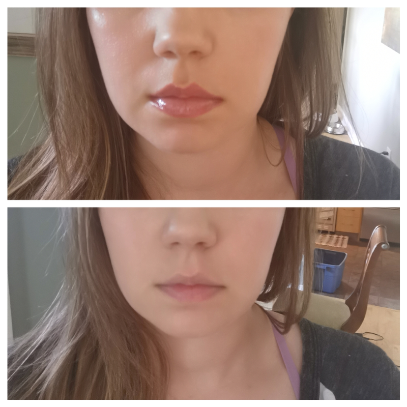 too faced lip injection before after